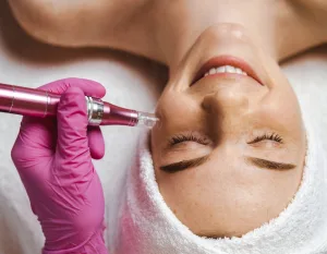 Ανακάλυψε τη θεραπεία Micro Needling με μικροβελόνες στο Chic and Beauty! Βελτίωσε ρυτίδες, λεπτές γραμμές, ουλές ακμής & ραγάδες.